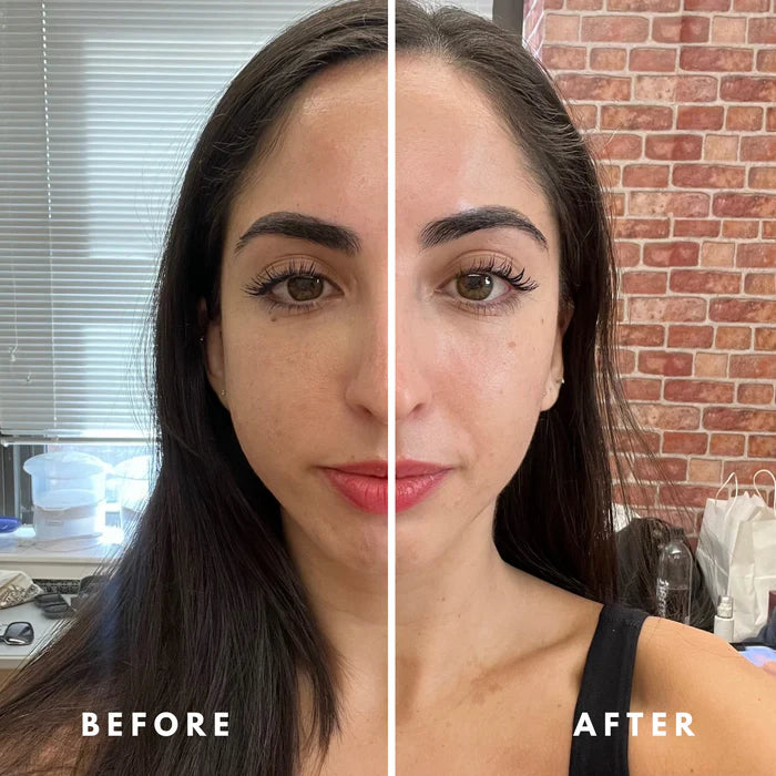 Professional Lymphatic Drainage Brush 🌿 | Ergonomic Design for Daily Skincare & Wellness ✨